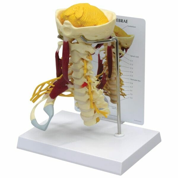 Deluxe Muscled Cervical Spine Vertebrae Model