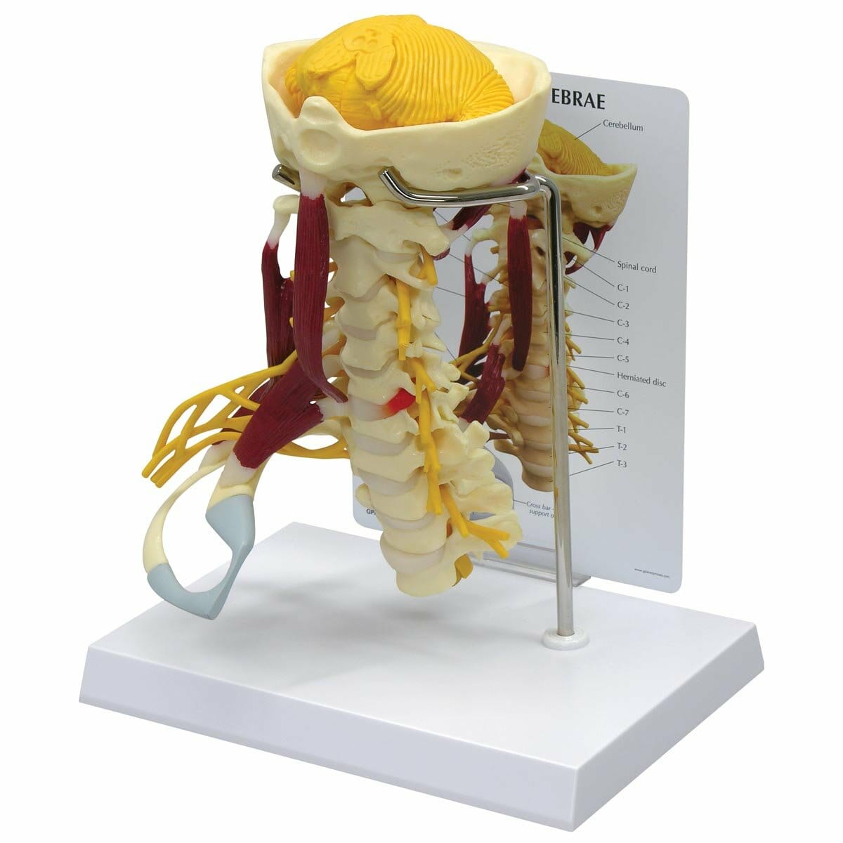 Cervical Spine Anatomy Model | My XXX Hot Girl