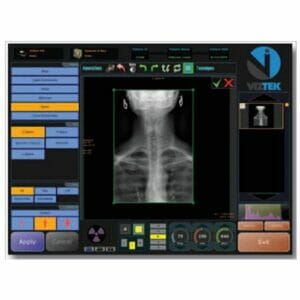 Digital X-Ray System with Installation & Training