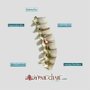 Spine Conditions - Removable Wall Graphic