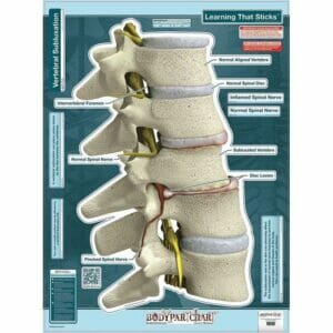 Subluxation - Labeled Removable Wall Graphic