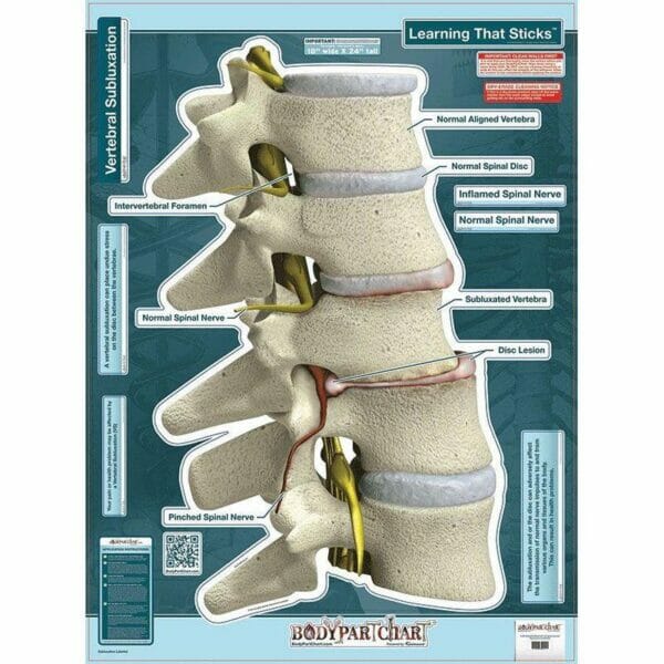 Subluxation - Labeled Removable Wall Graphic