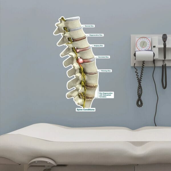 Spine Conditions - Labeled Removable Wall Graphic