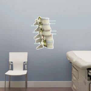 Subluxation - Labeled Removable Wall Graphic