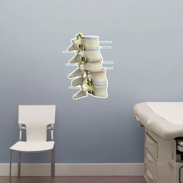 Subluxation - Labeled Removable Wall Graphic