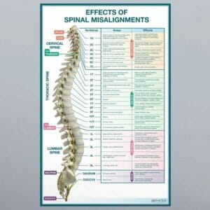 Effects of Spinal Misalignments - Removable Wall Graphic - X-Large (54" x 80")