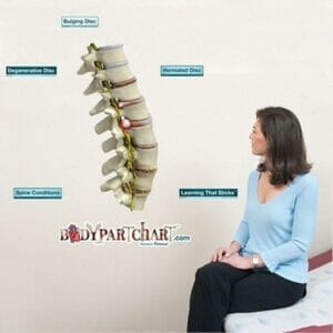 Spine Conditions - Removable Wall Graphic