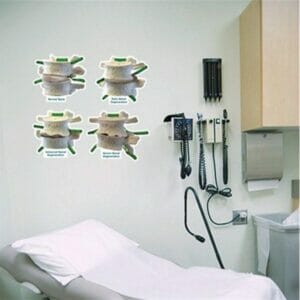 Spinal Degeneration - Labeled Removable Wall Graphic