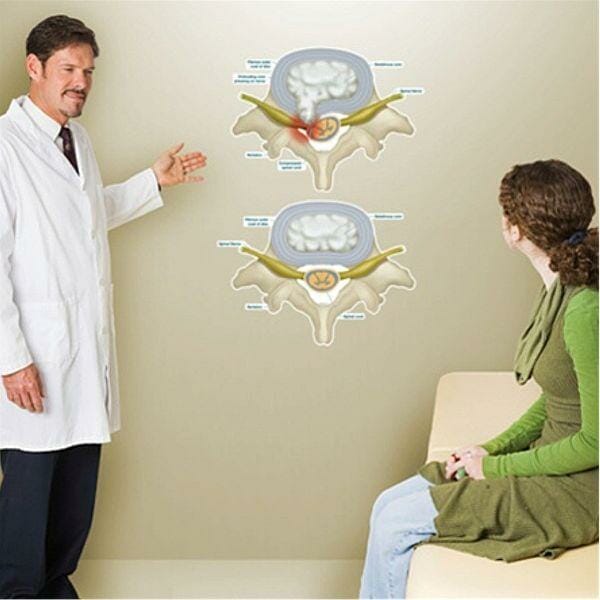 Prolapsed Disc - Labeled Removable Wall Graphic